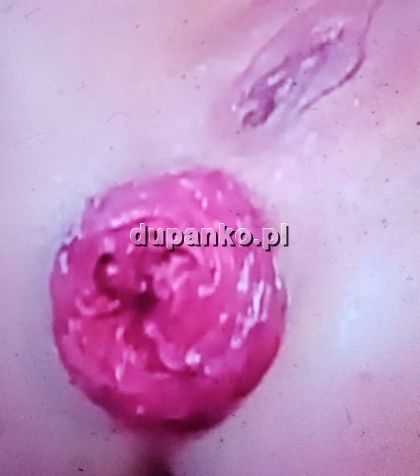 Fisting cipki chętne zapraszam do kontaktu, Poznań, wielkopolskie - erotic offer photo nr 2