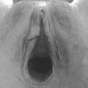 Fisting dla pań, Poznań, wielkopolskie - sex anons zdjęcie nr 1